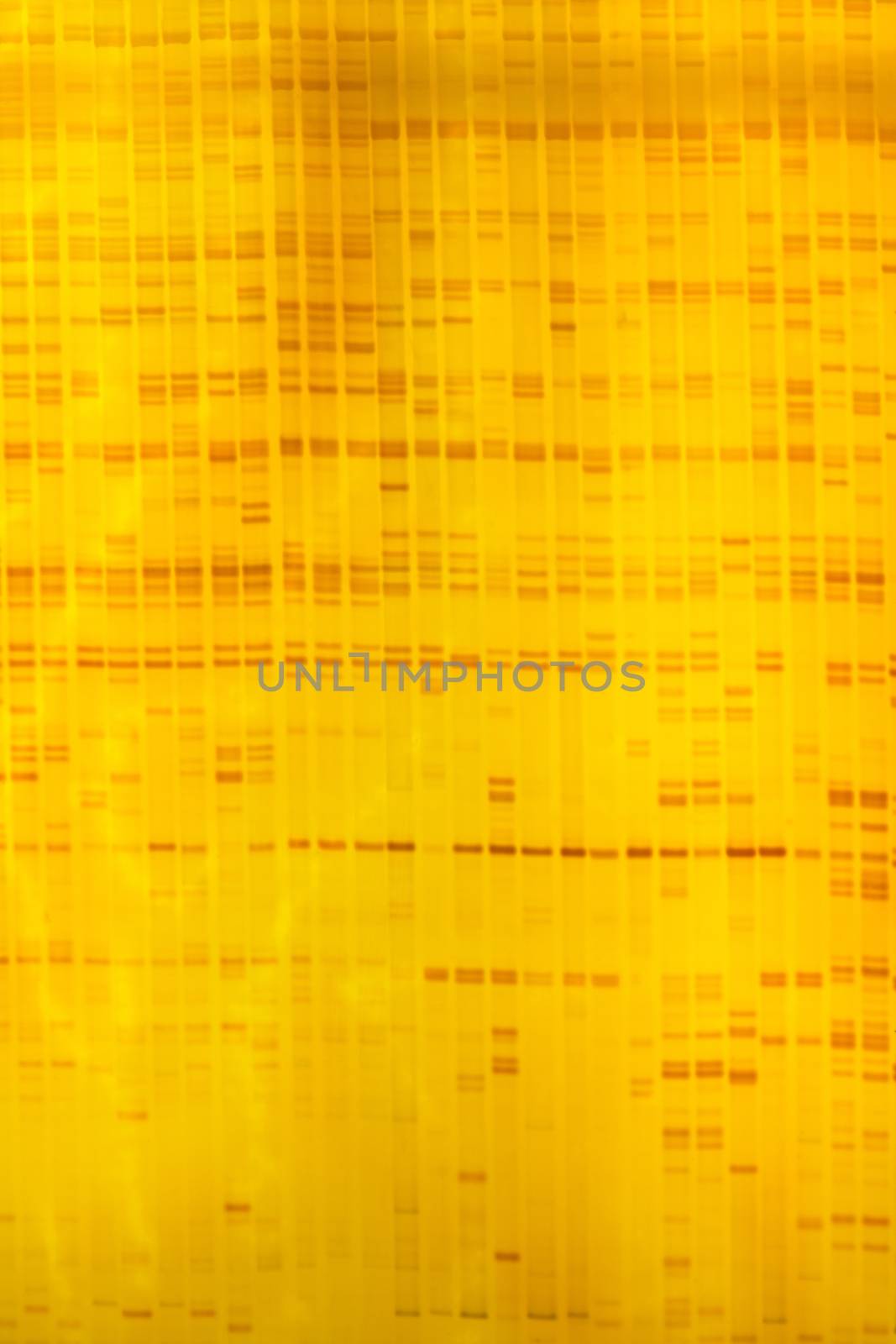 Plant DNA fingerprint on acrylamine gel electrophoresis result