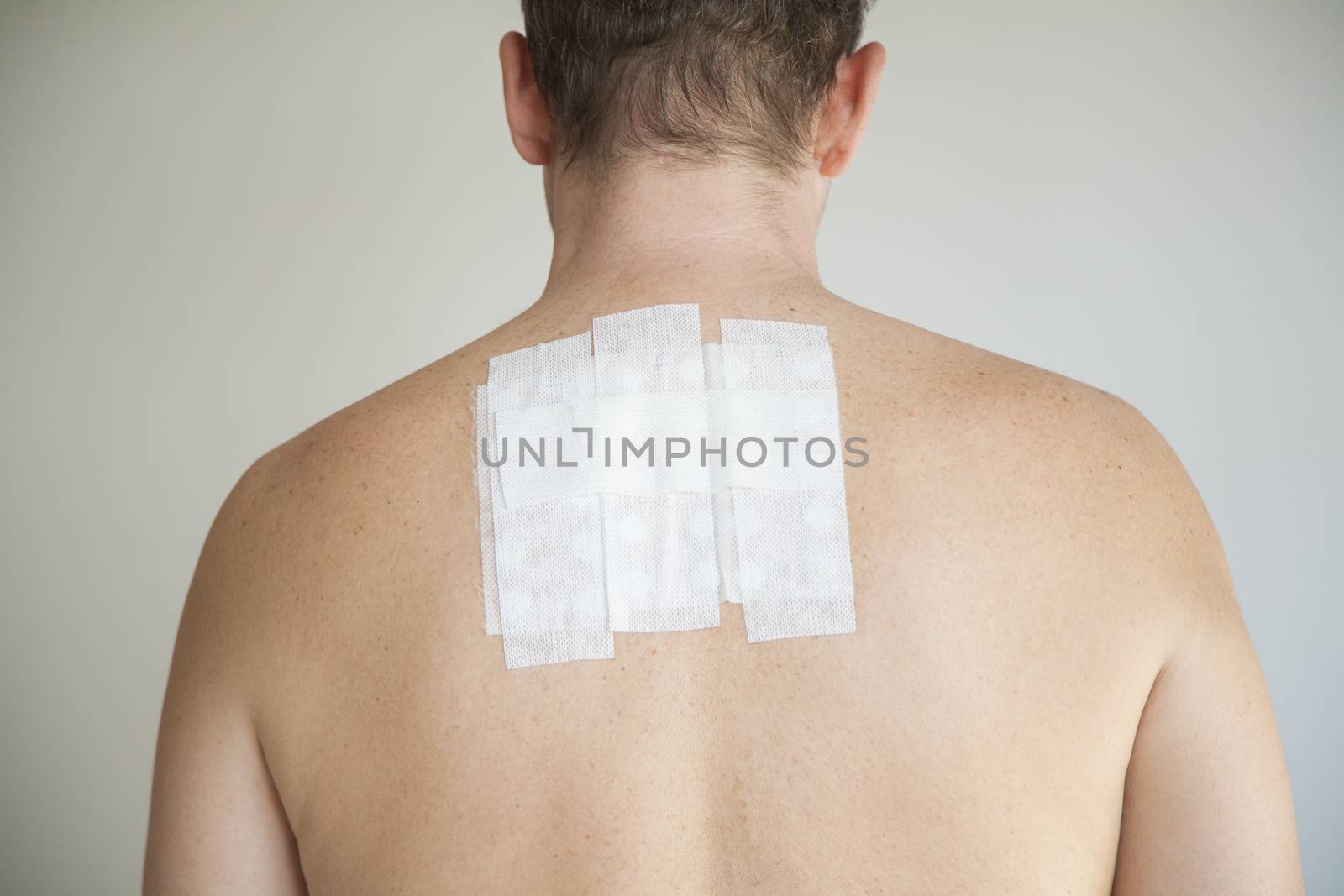 bare man back with contact allergy test in white adhesive plaster