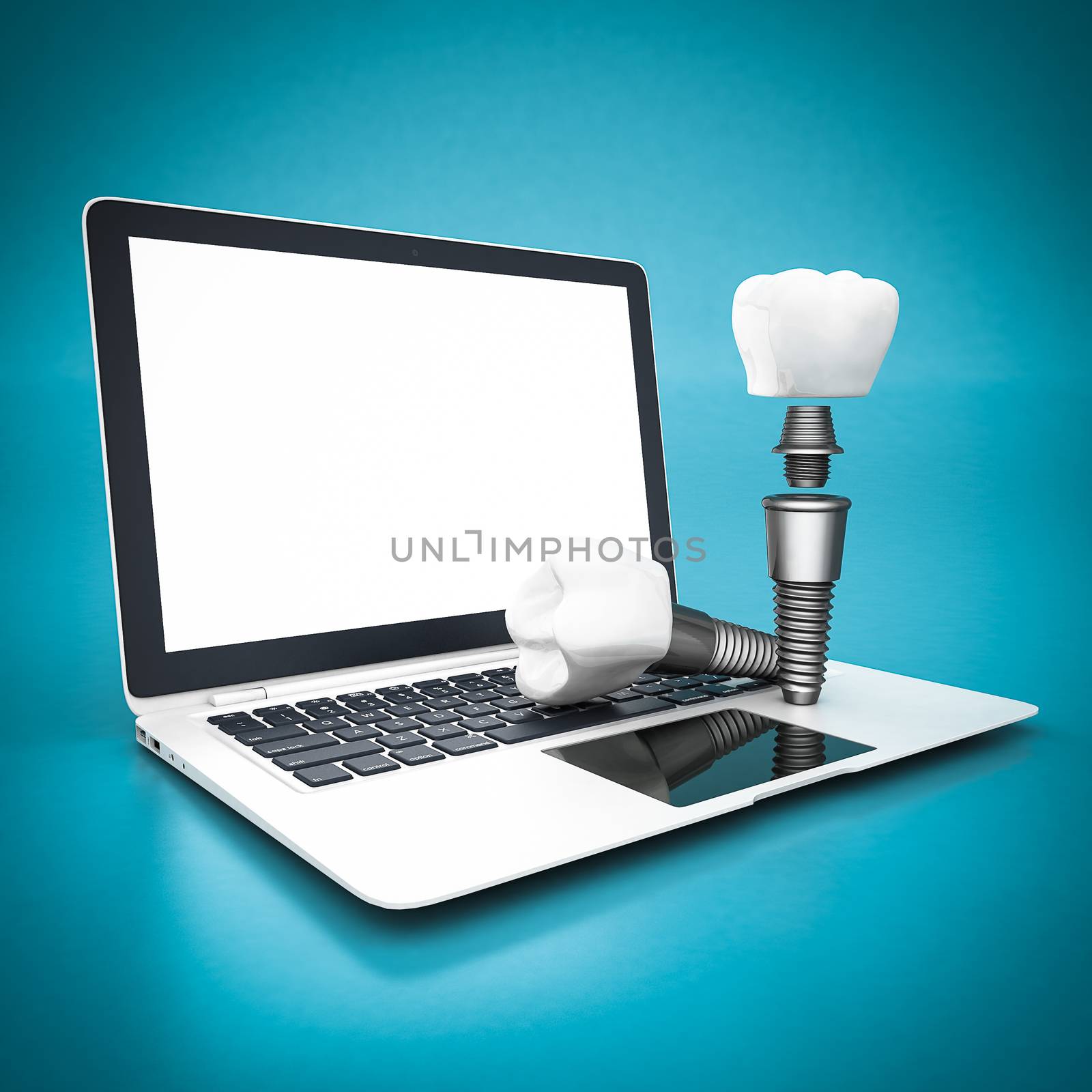 picture of dental implants on a white background