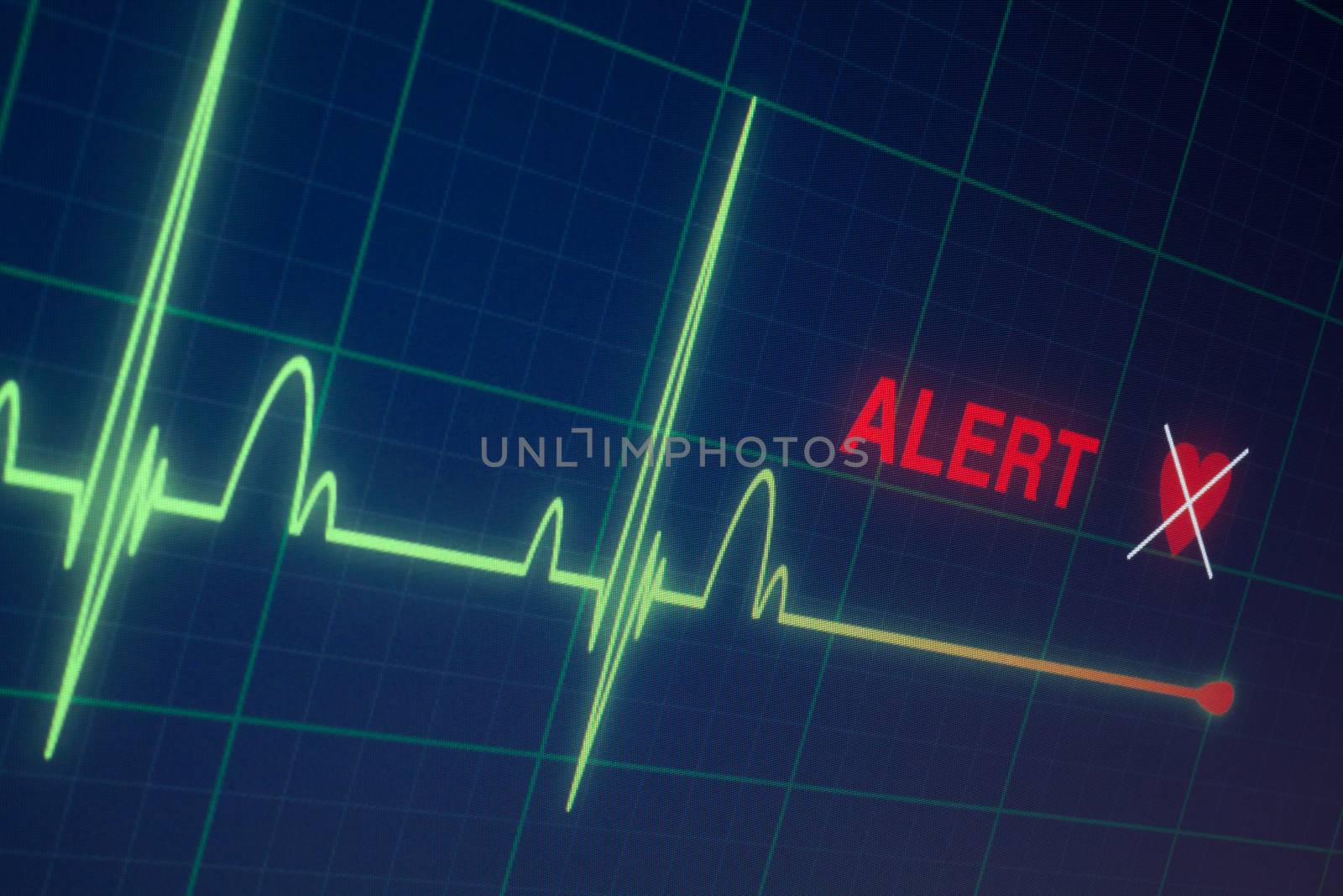 Flat line alert on a heart monitor.