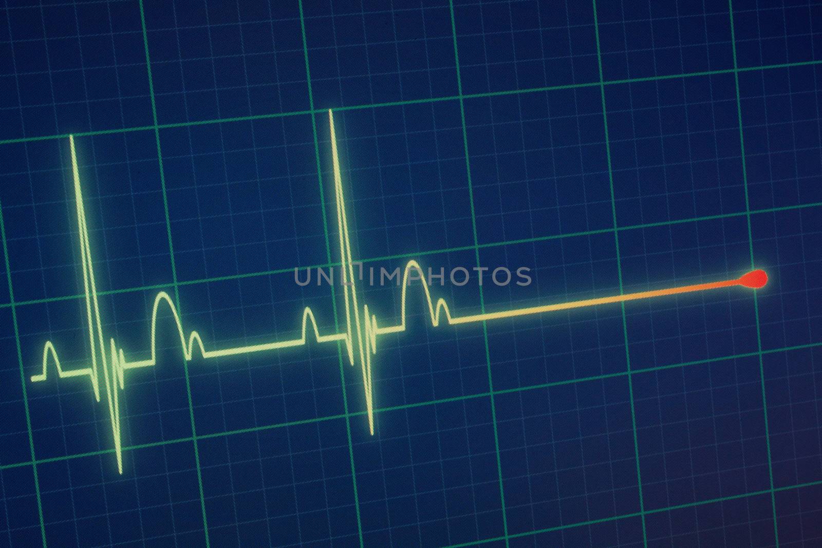 Flatline blip on a medical heart monitor ECG / EKG (electrocardiogram) with blue background