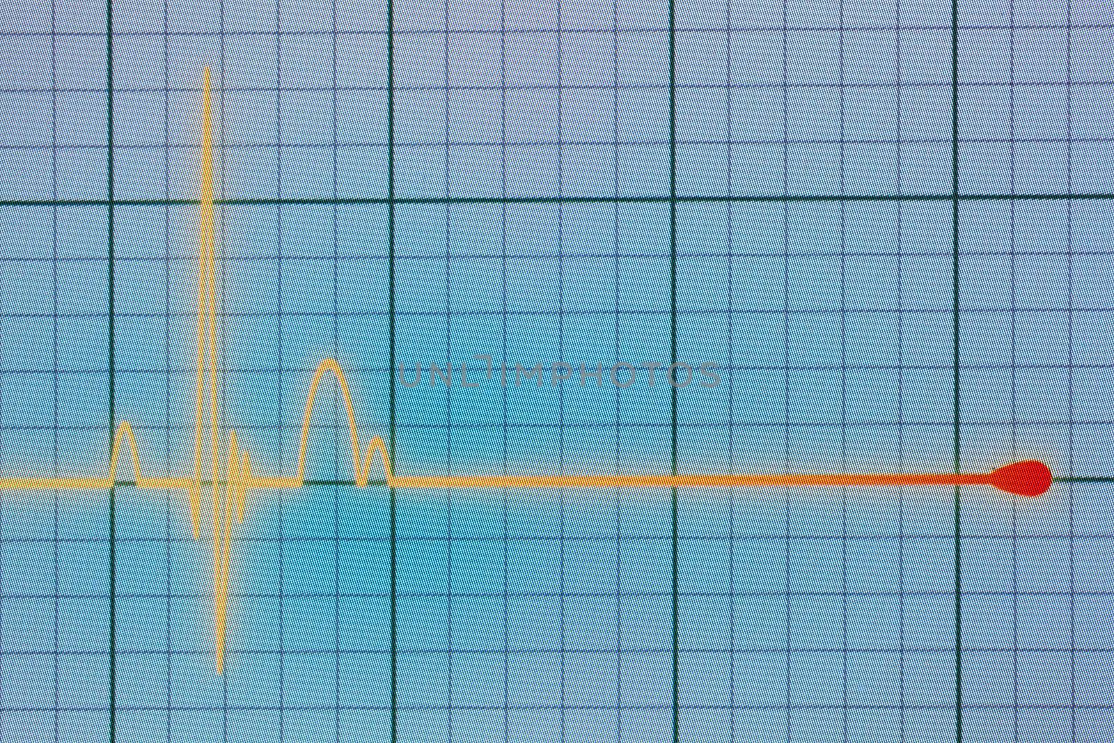 Flatline blip on a medical heart monitor ECG / EKG (electrocardiogram) with blue background