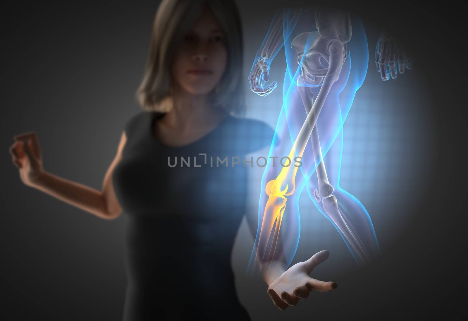 woman and hologram with knee radiography by videodoctor
