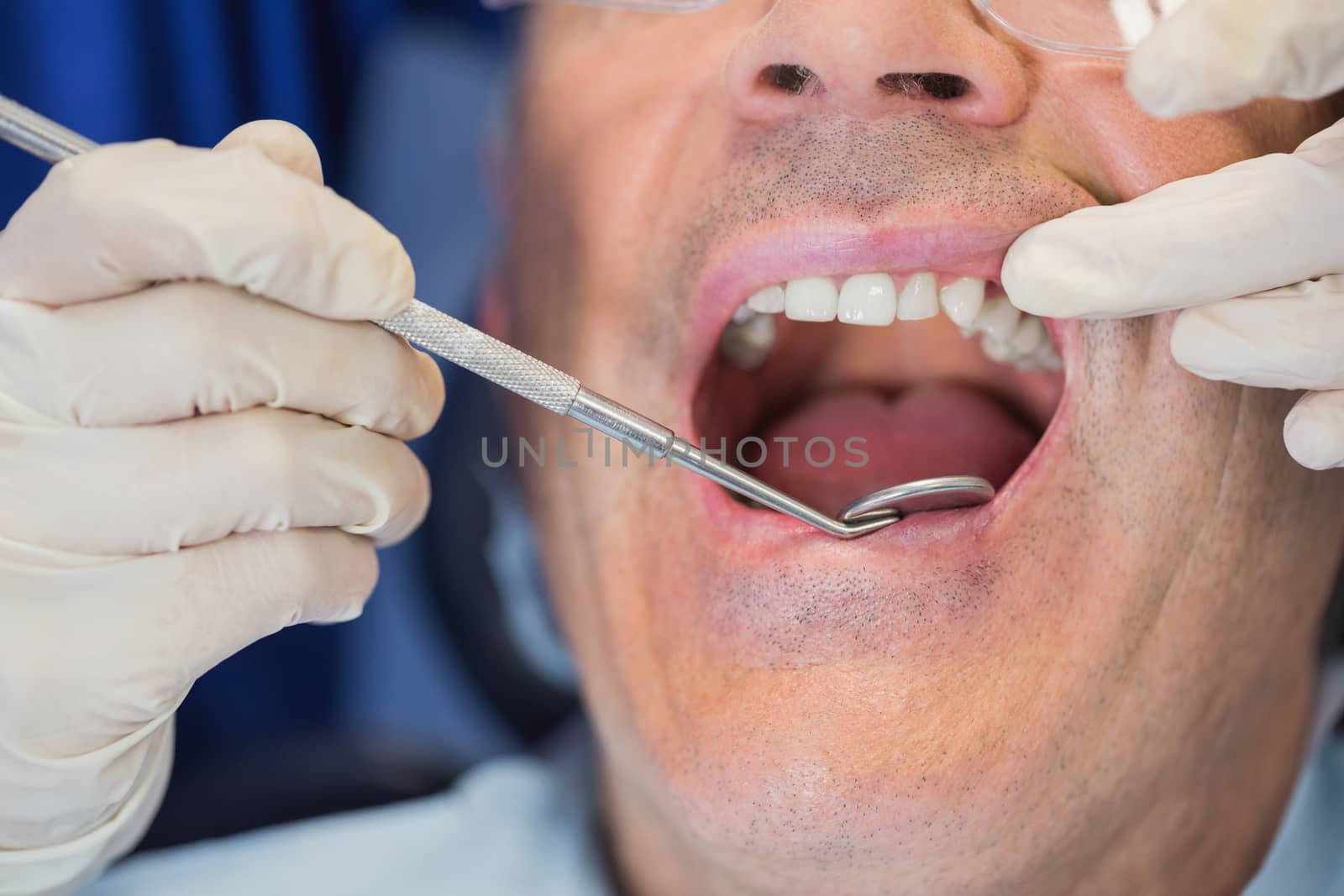 Patient mouth open and dentist examining by Wavebreakmedia