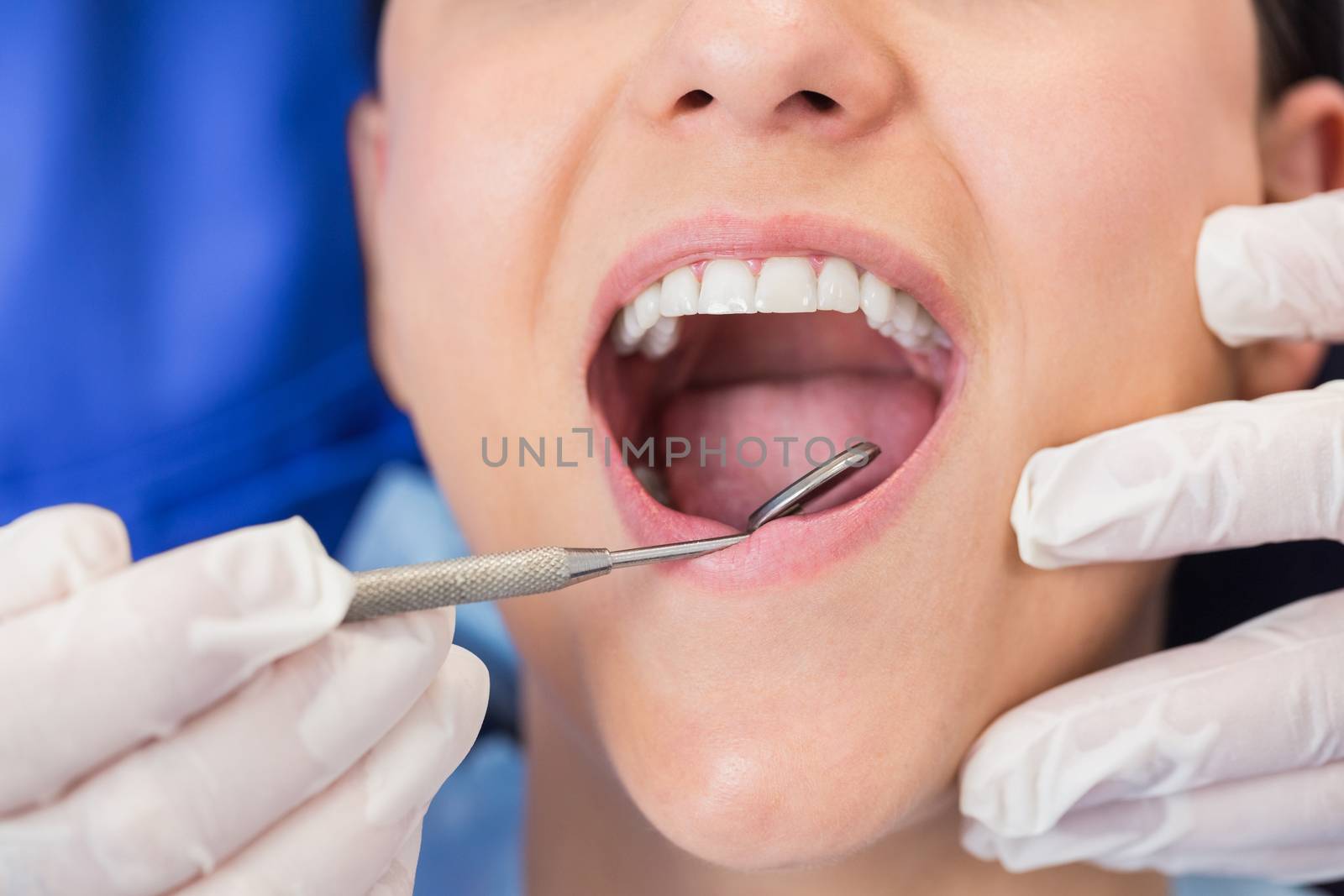 Dentist examining a patient with angle mirror by Wavebreakmedia