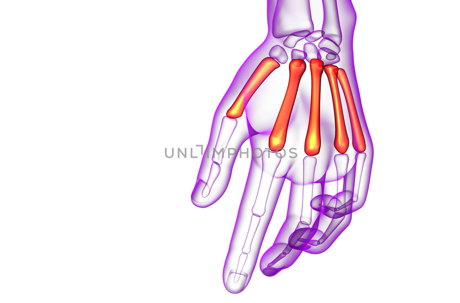 3d render medical illustration of the metacarpal bone  by maya2008