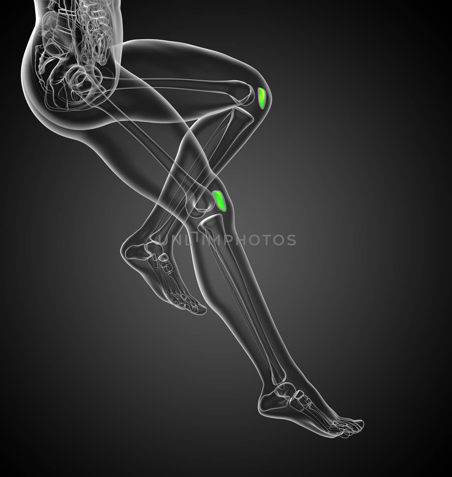 3D medical illustration of the patella bone - side view