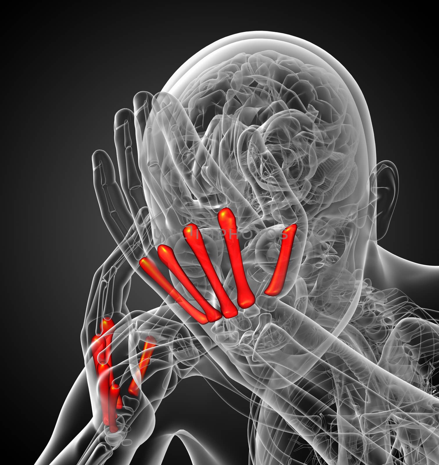 3d render medical illustration of the metacarpal bone - front view