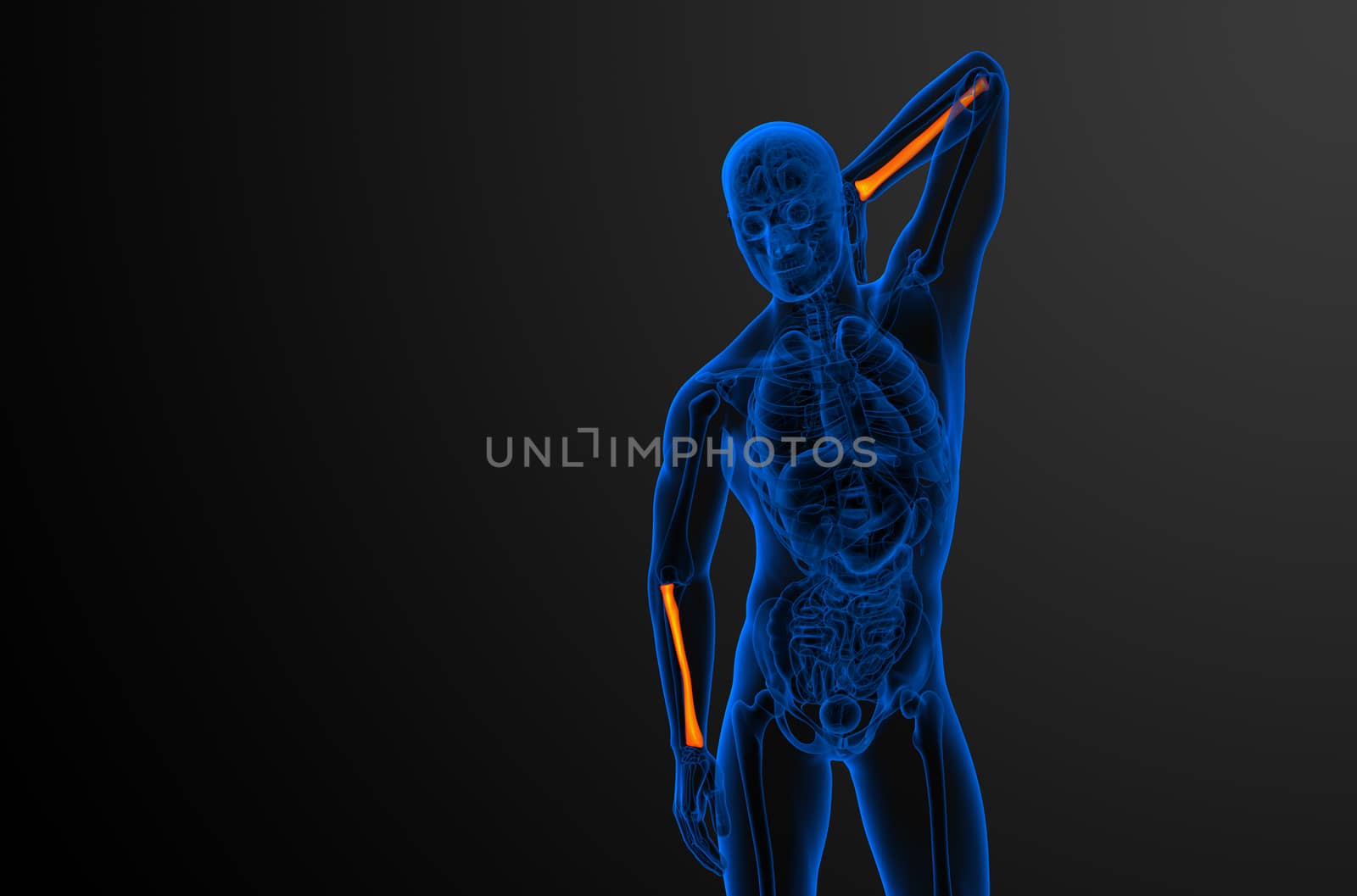 3d render medical illustration of the radius bone - front view