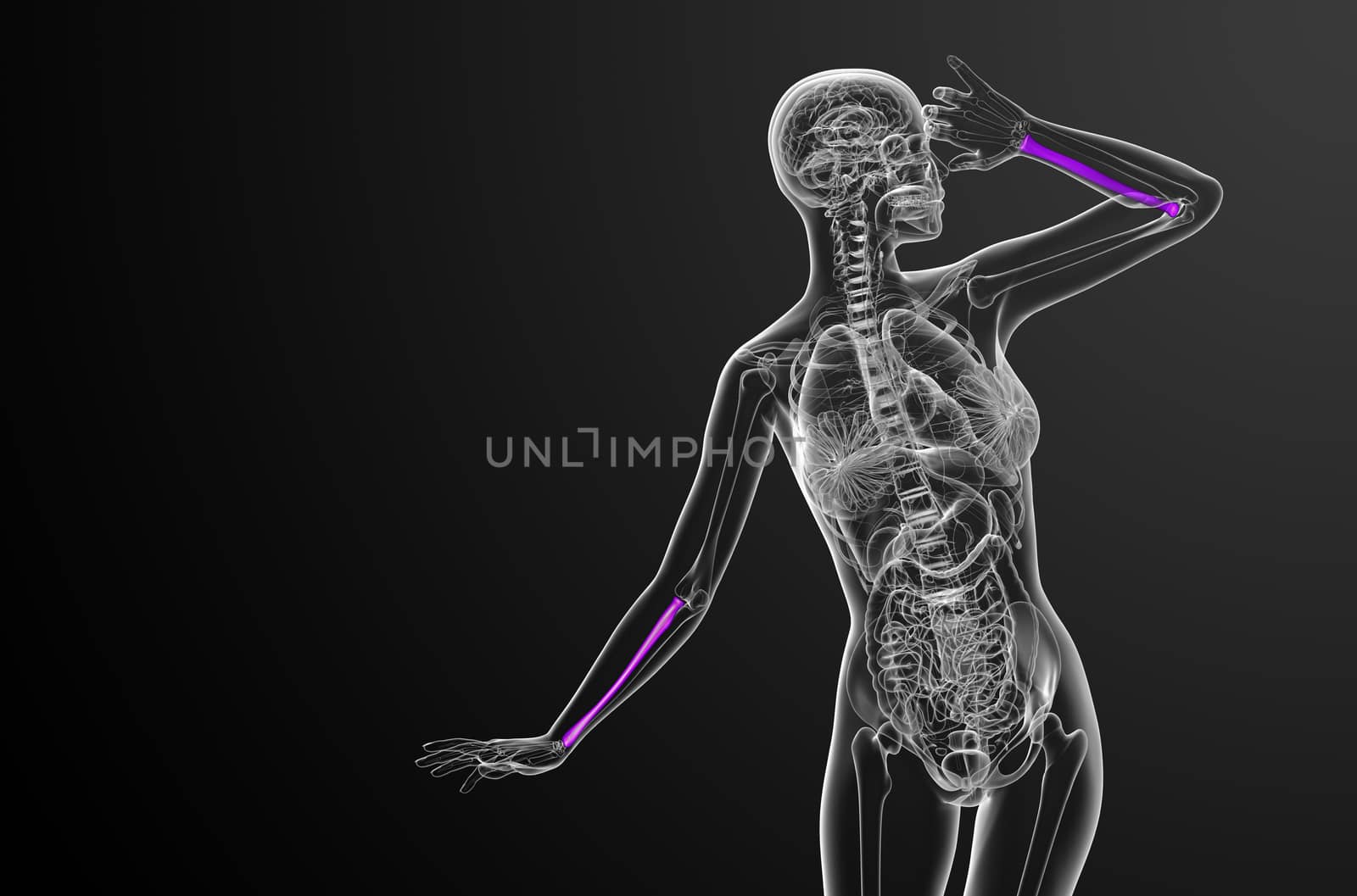 3d render medical illustration of the radius bone - front view