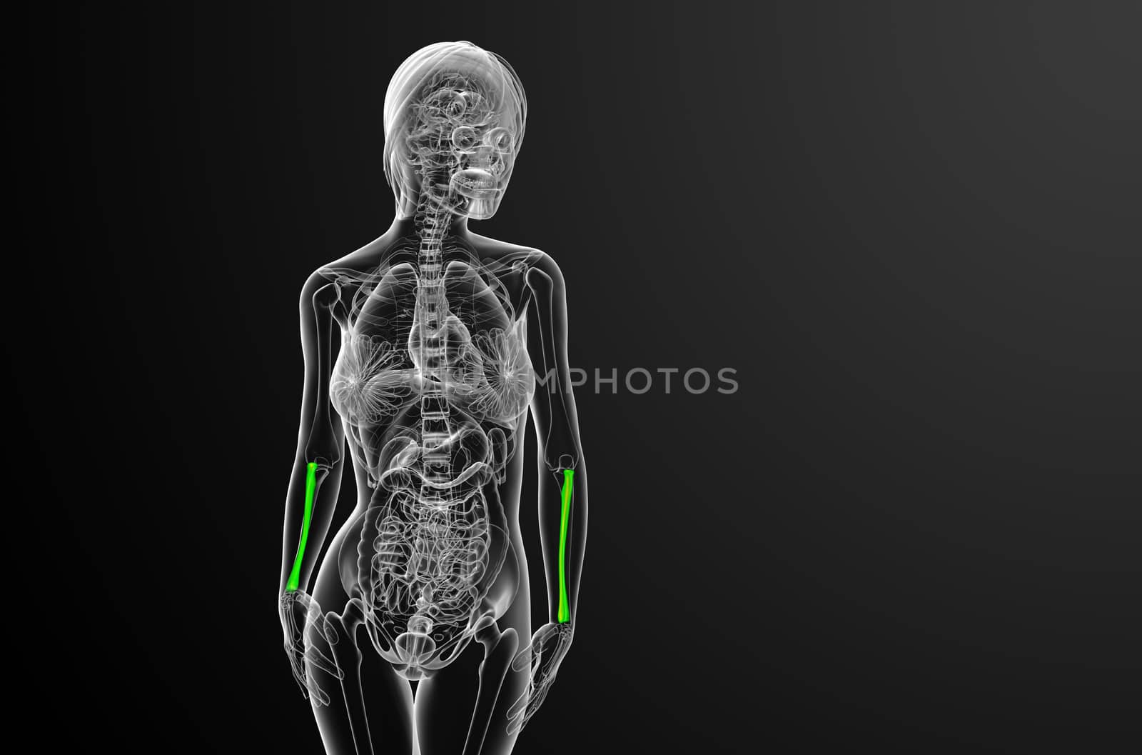 3d render medical illustration of the radius bone - front view