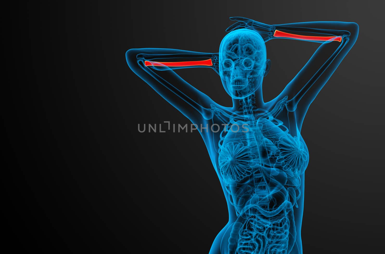 3d render medical illustration of the radius bone - front view