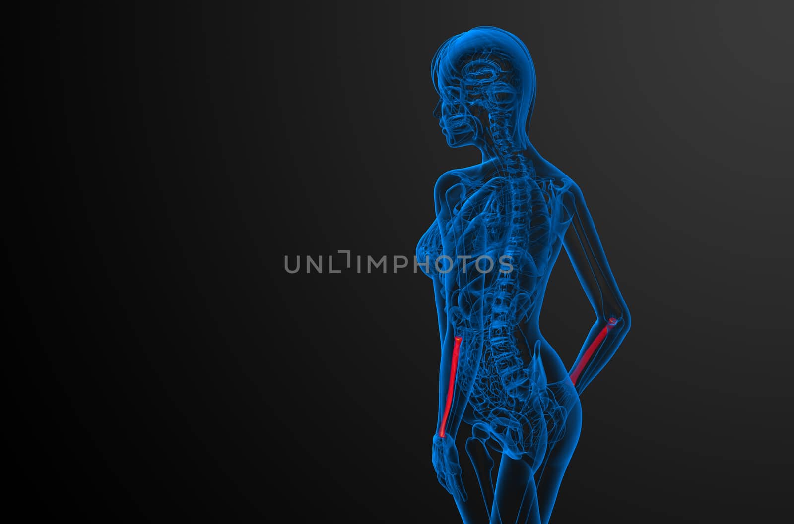 3d render medical illustration of the radius bone - side view