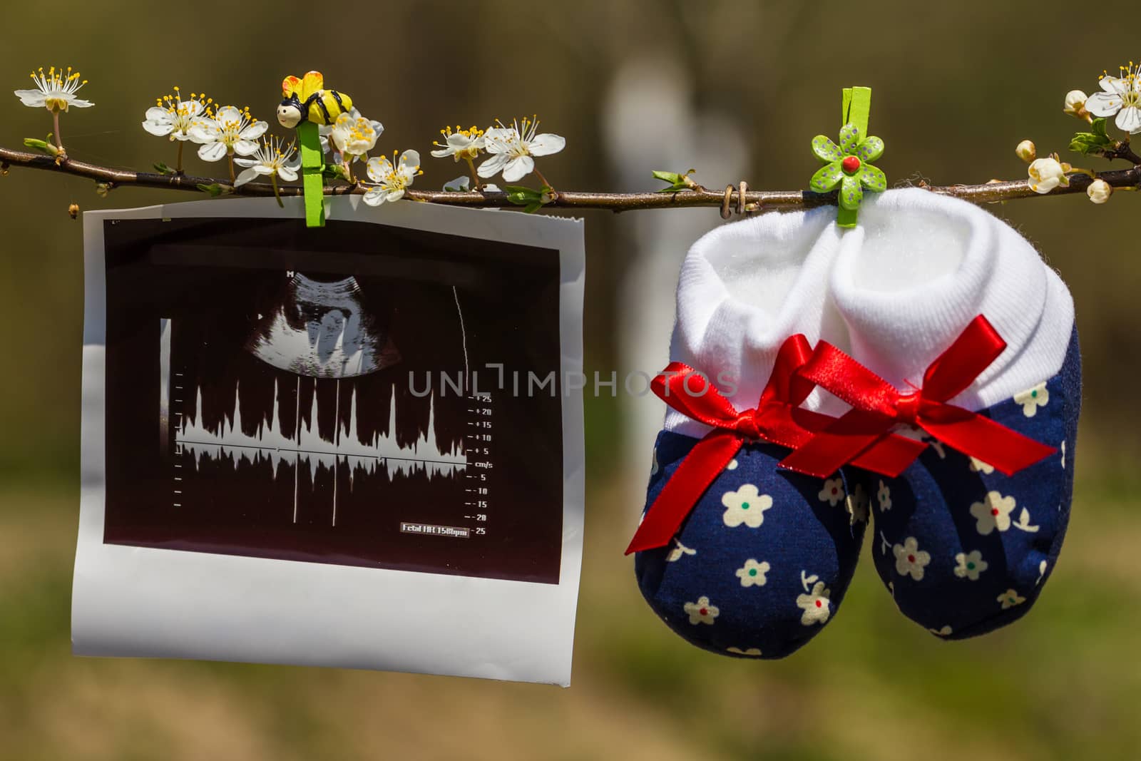 Baby slippers and ultrasound image hanging on a branch of blossoming tree