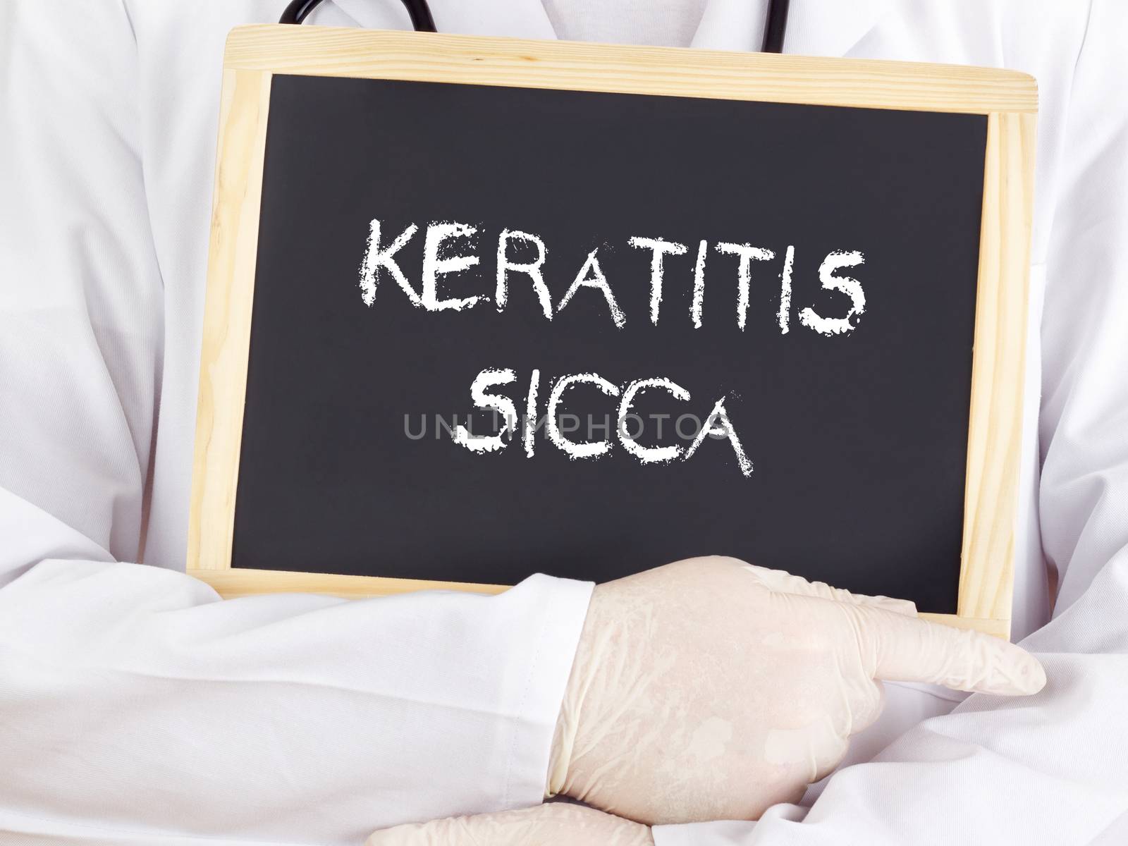 Doctor shows information: keratitis sicca
