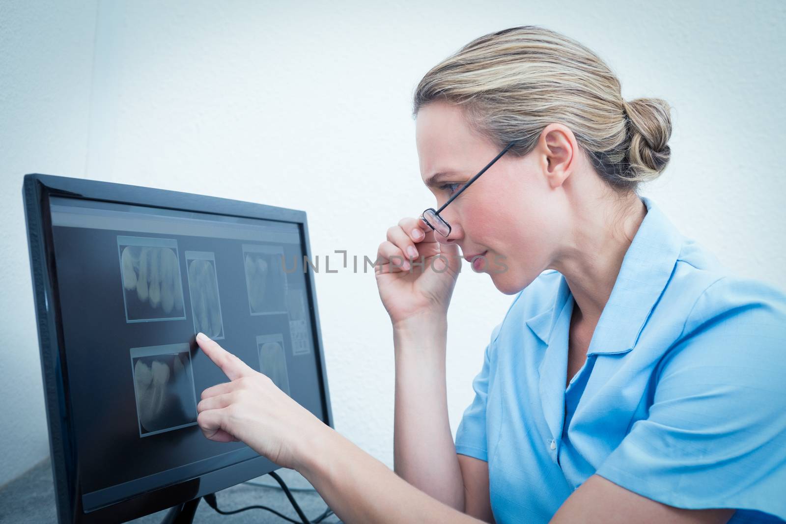 Female dentist looking at x-ray on computer by Wavebreakmedia