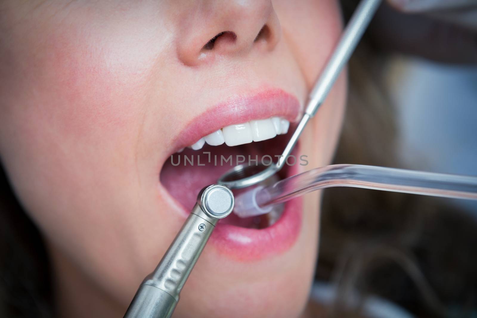Close up of woman having her teeth examined by Wavebreakmedia