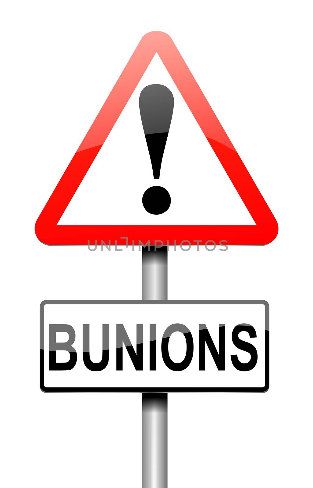 Illustration depicting a sign with a bunions concept.