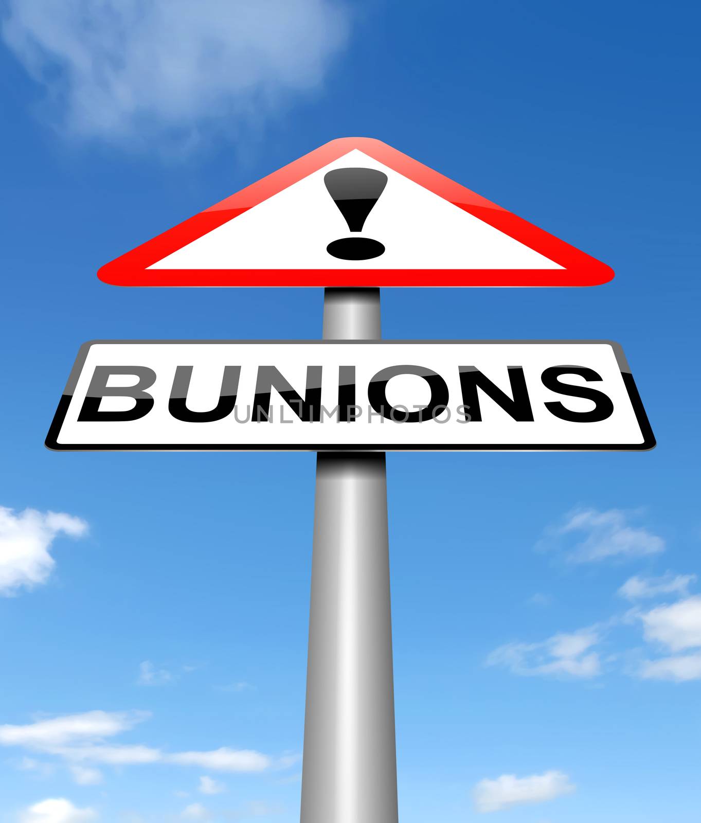 Illustration depicting a sign with a bunions concept.