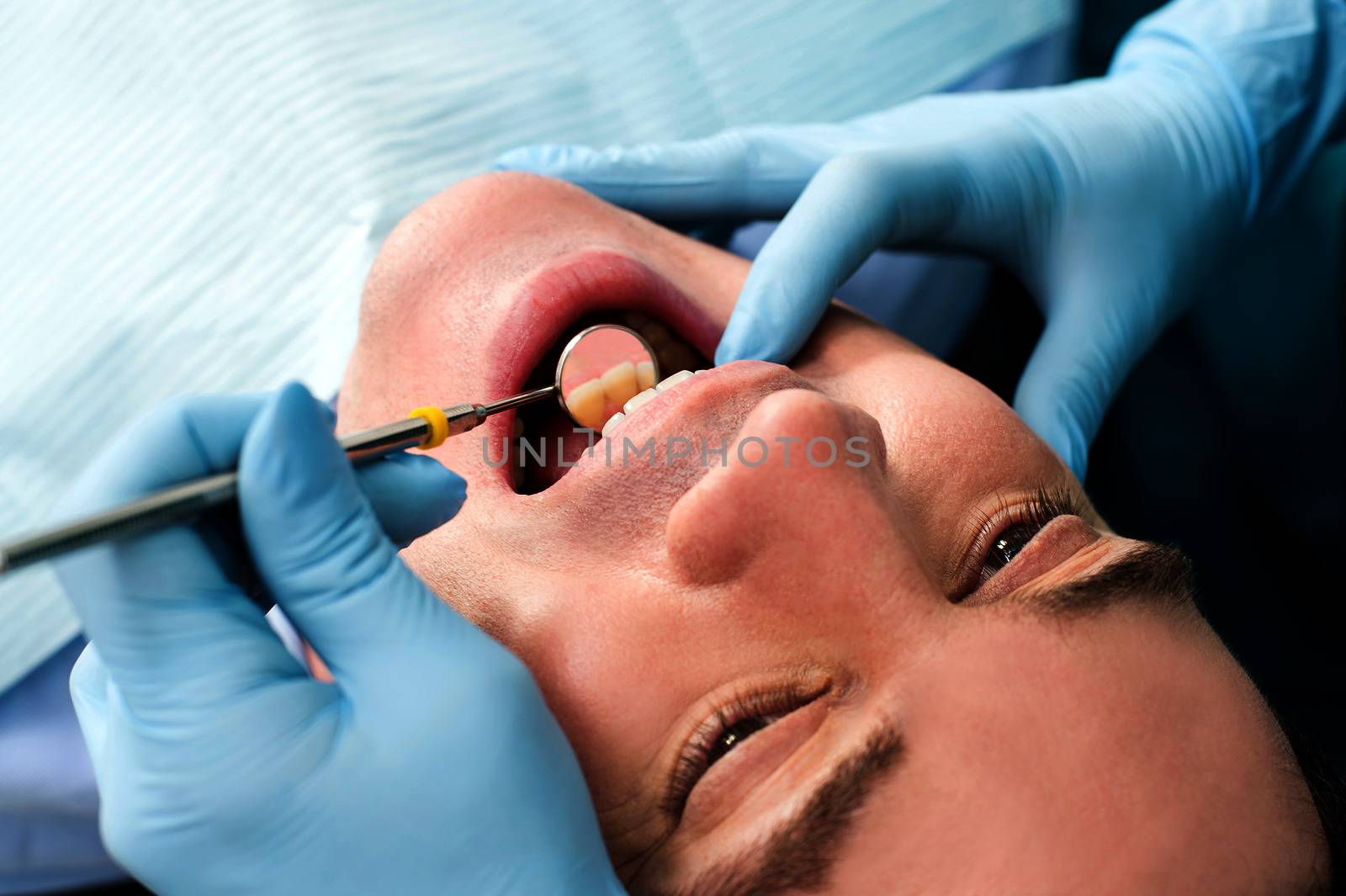 Teeth examined by dentist by stockyimages