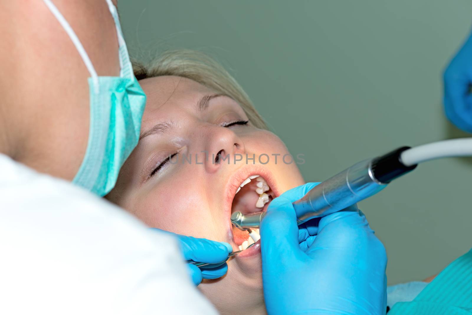 Close-up of young female having her teeth cleaned at dentist office