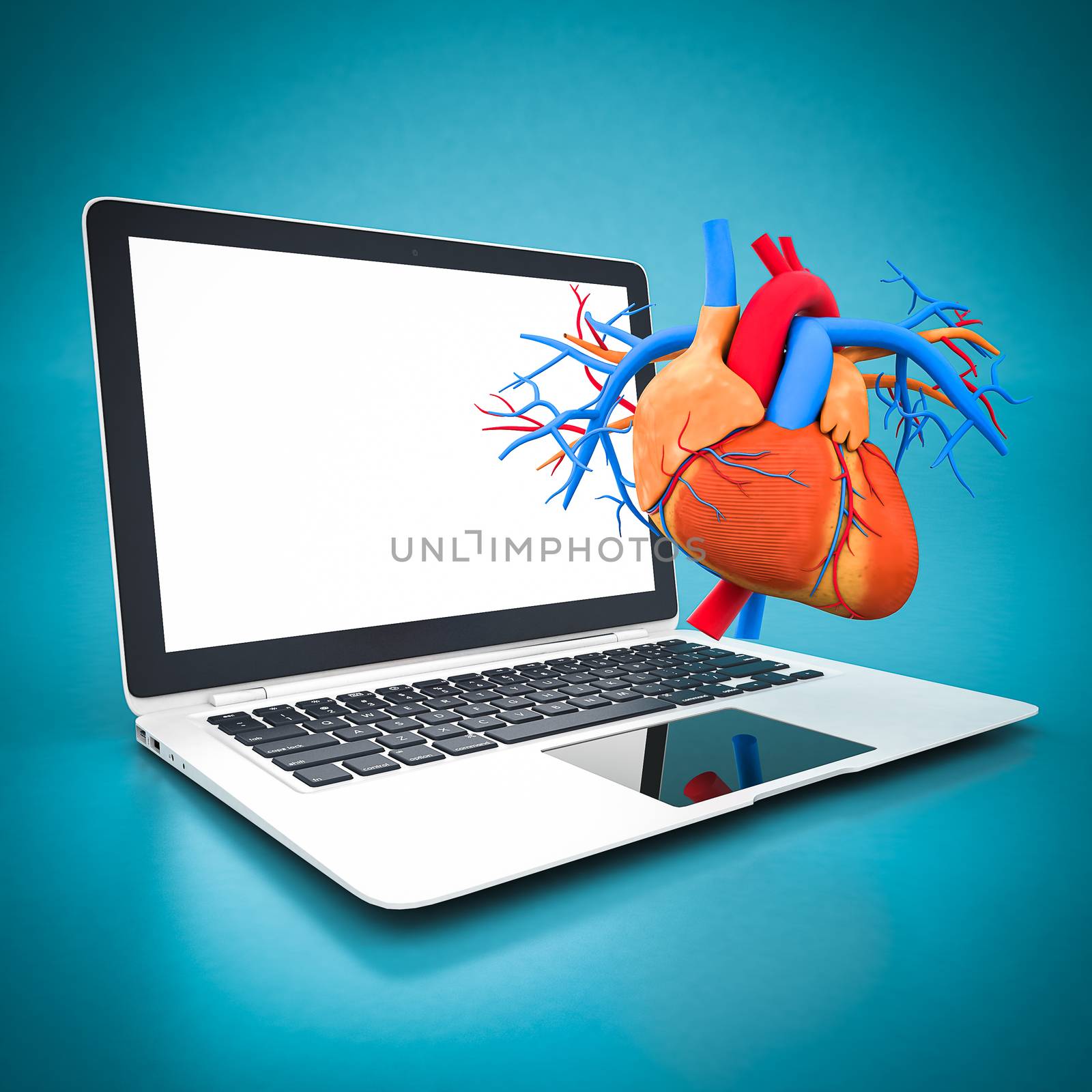 model of heart and white laptop on a blue background