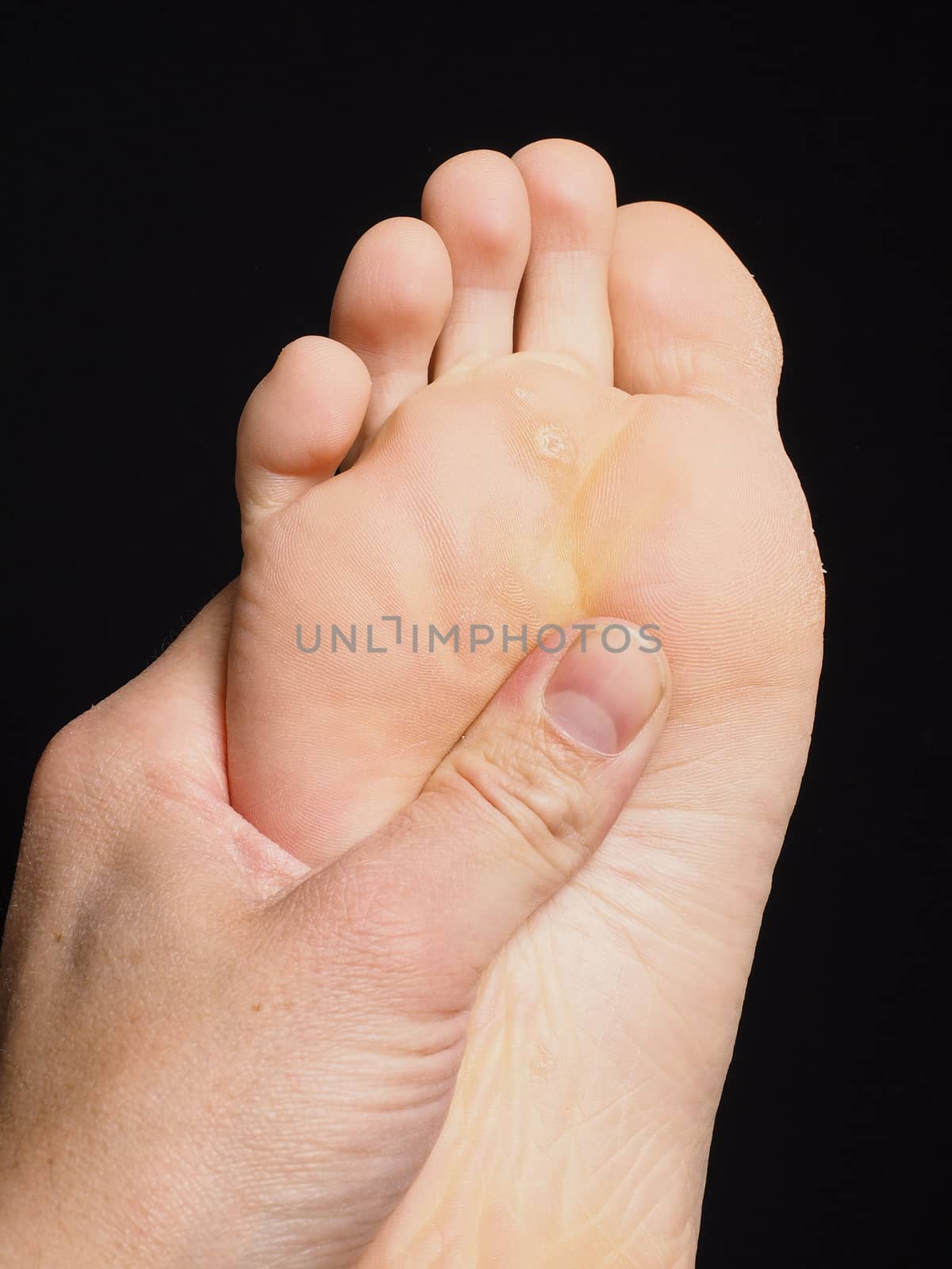 Pressure point massage under foot with thumb isolated towards black