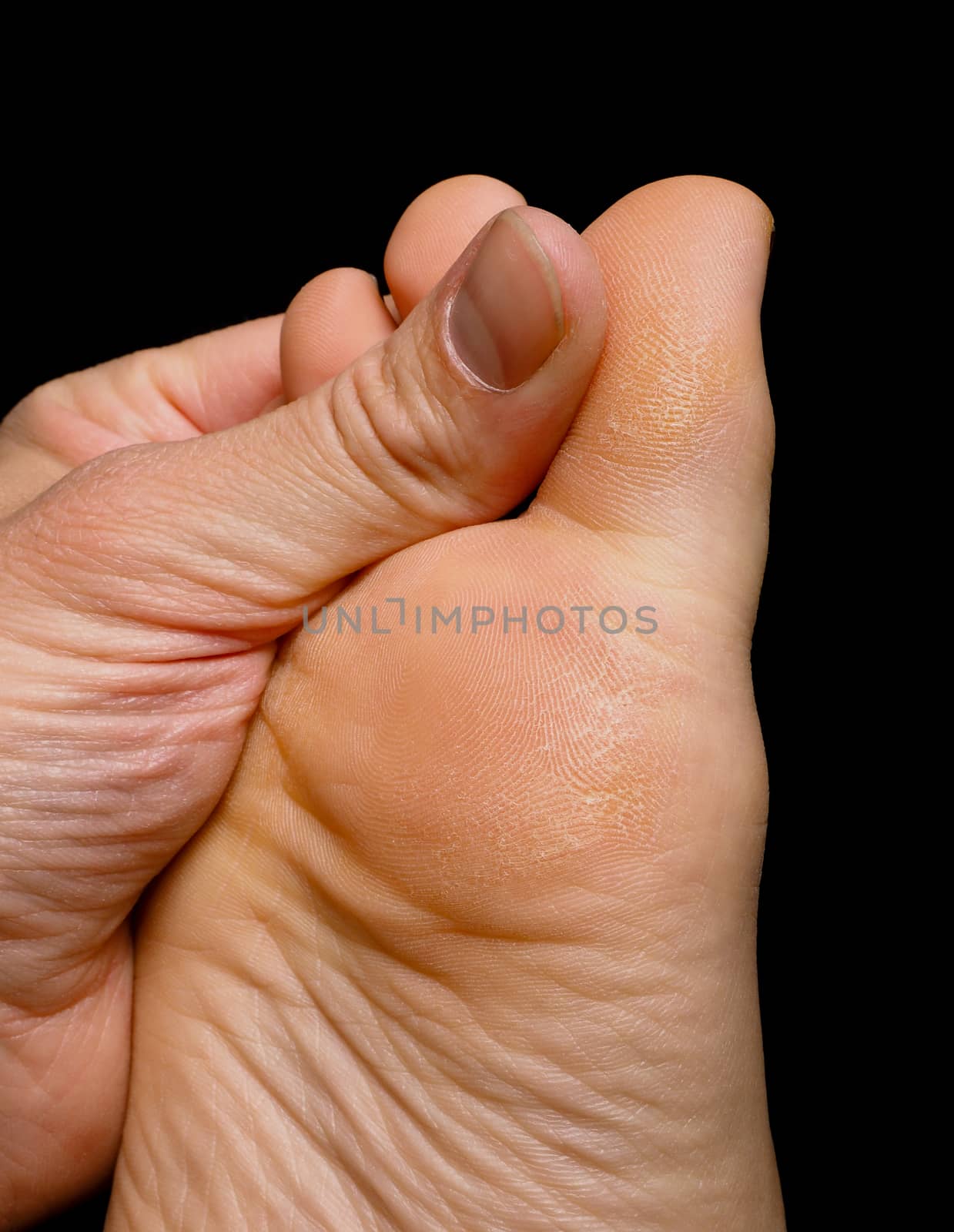 Thumb pressure on big toe massage on dry skin isolated towards black