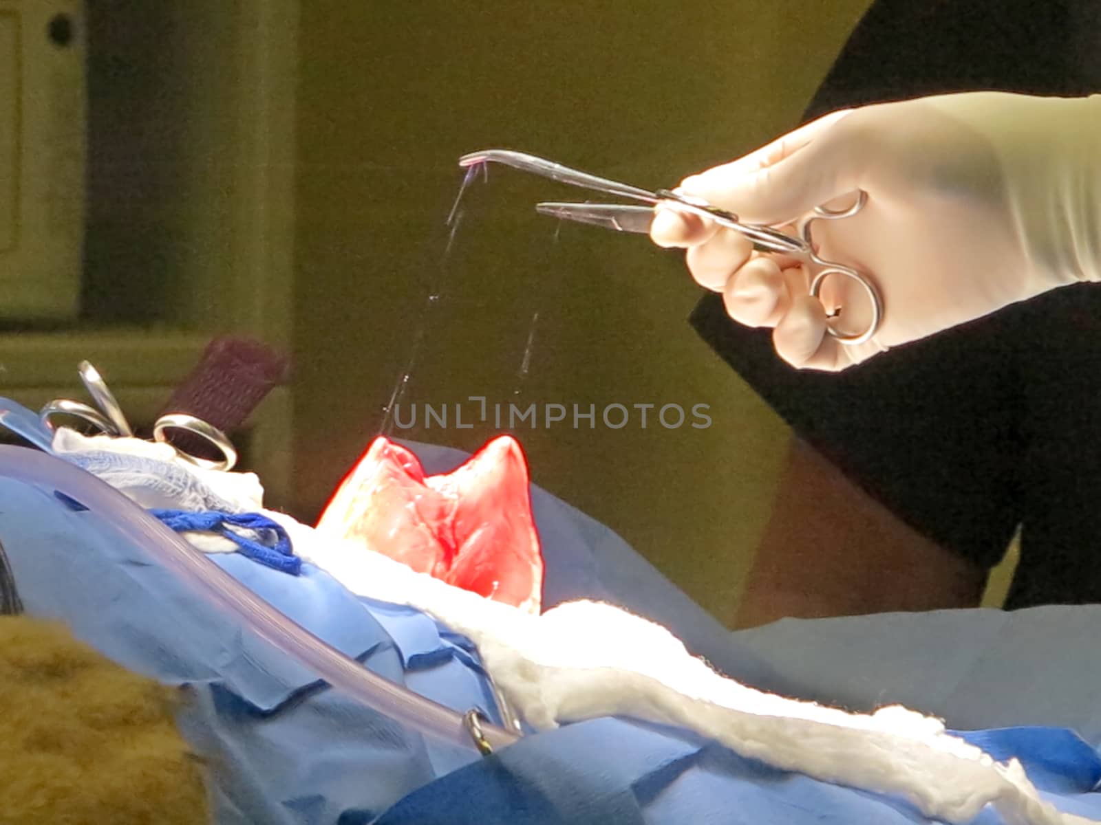 Stomach Suturing by quackersnaps