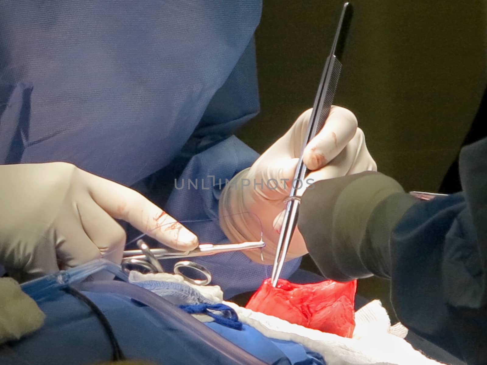 Stomach Suturing by quackersnaps