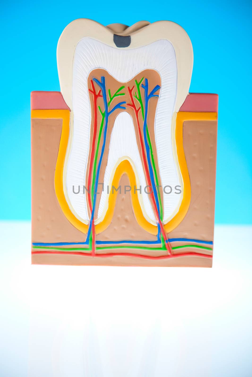 Human tooth structure, bright colorful tone concept by JanPietruszka