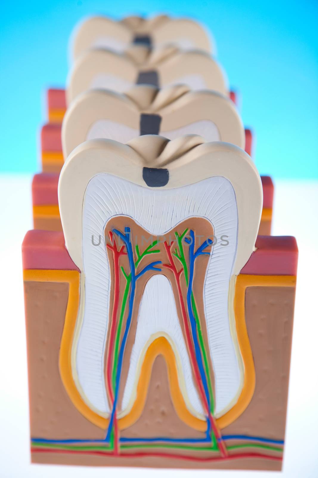 Tooth, bright colorful tone concept by JanPietruszka