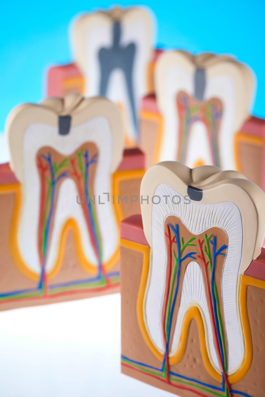 Tooth anatomy, bright colorful tone concept by JanPietruszka