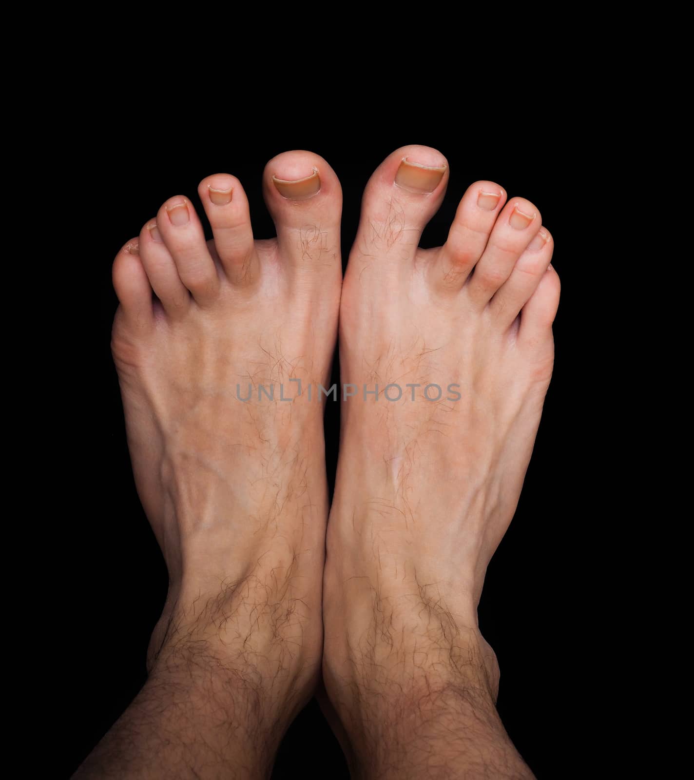 Pair of caucasian male feet isolated towards black by Arvebettum