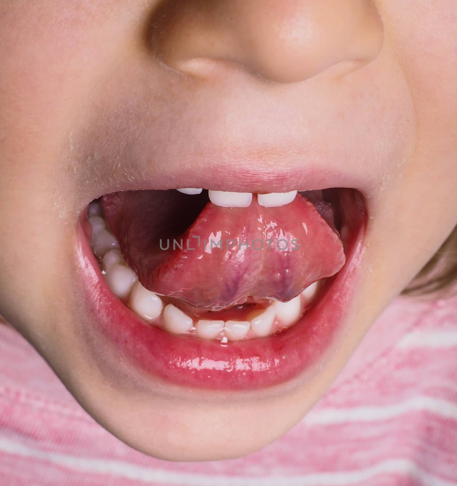 Little girl with pink shirt protruding tongue backwards with many white teeth