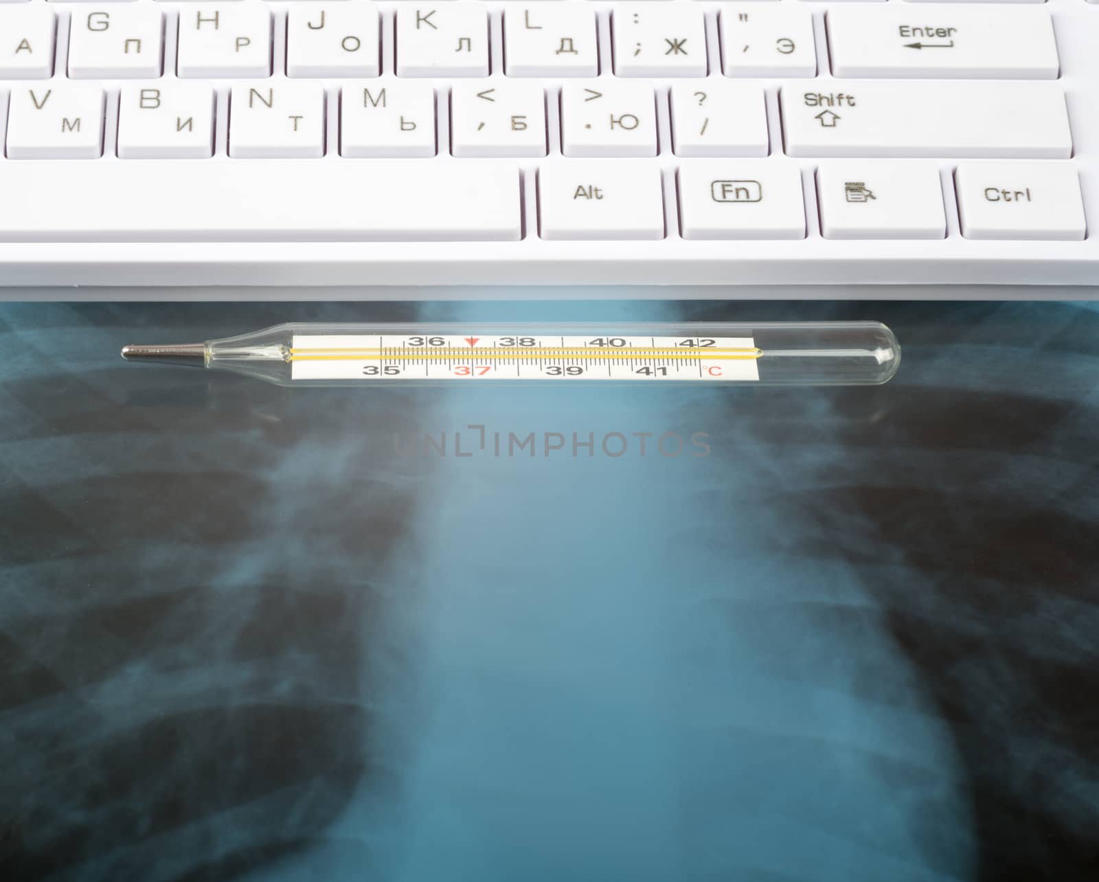 X-ray examination and white keyboard by cherezoff