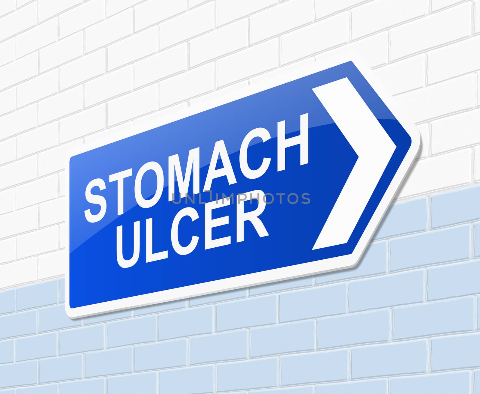 Illustration depicting a sign with a stomach ulcer concept.