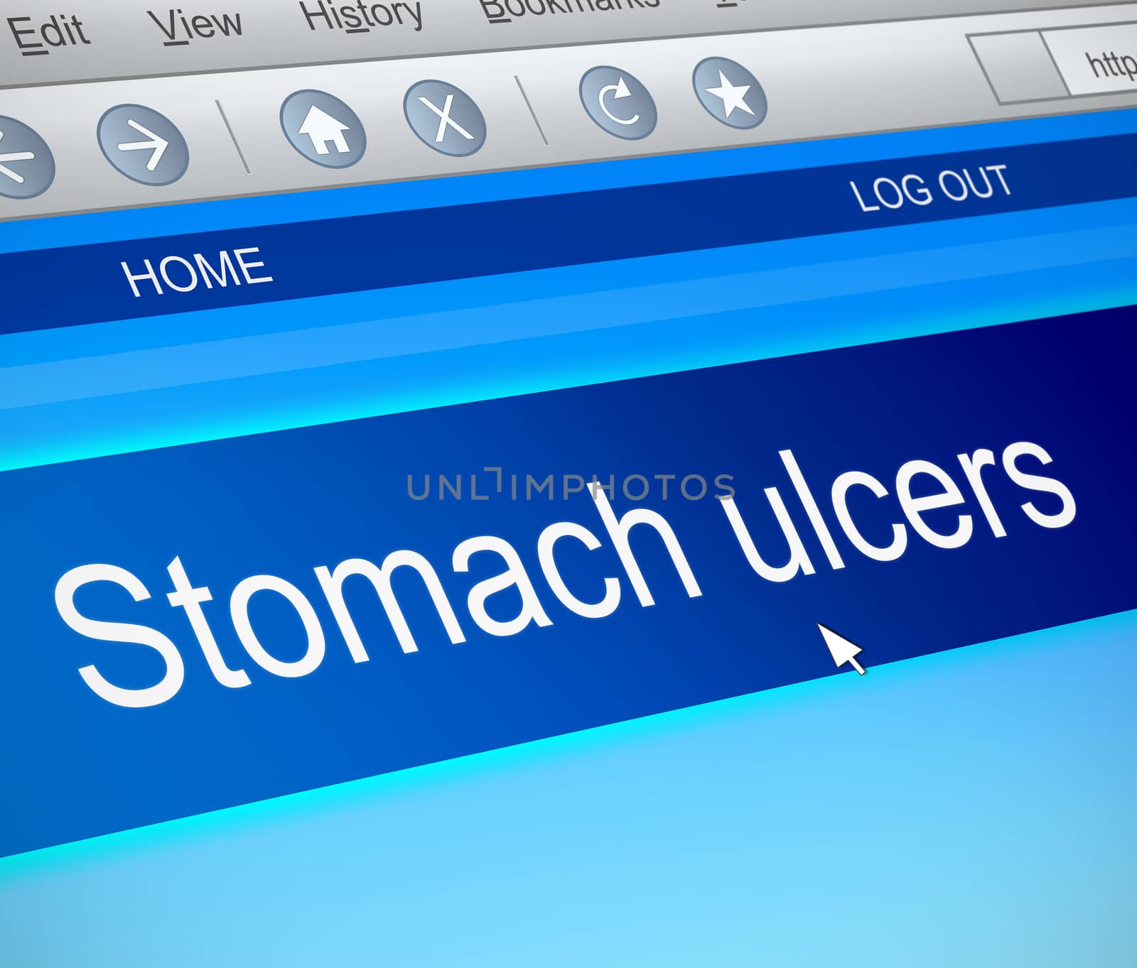 Illustration depicting a computer screen capture with a stomach ulcer concept.