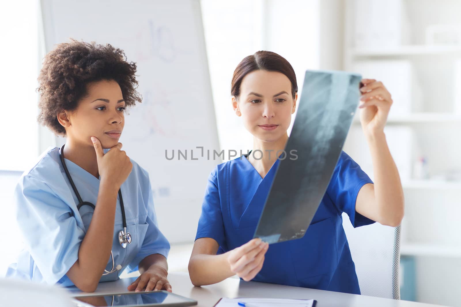 radiology, surgery, people and medicine concept - female doctors looking to and discussing x-ray image at hospital