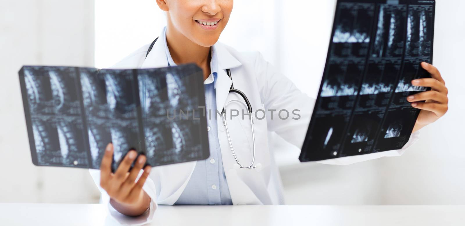 healthcare, medical and radiology concept - african doctor looking at x-ray