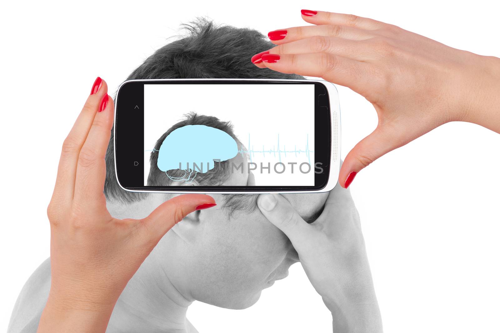 Headache. Young man touching his head and seeing the diagnosis on a smartphone screen. The future of medicine.