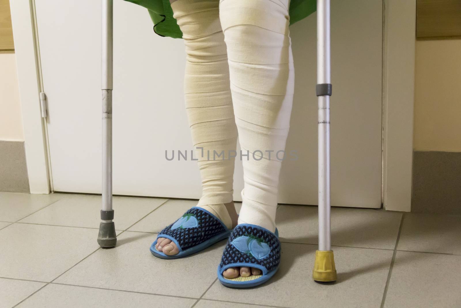 Photo of bandage on the legs with crutches