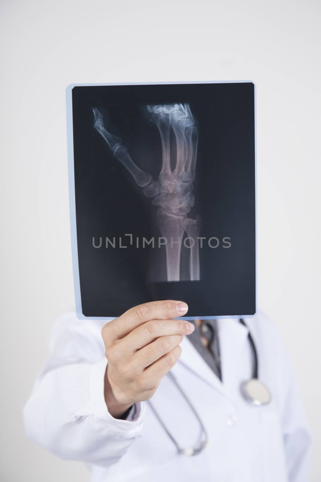 woman doctor with white gown and stethoscope with black radiography of hand skeleton in her hands isolated over white background