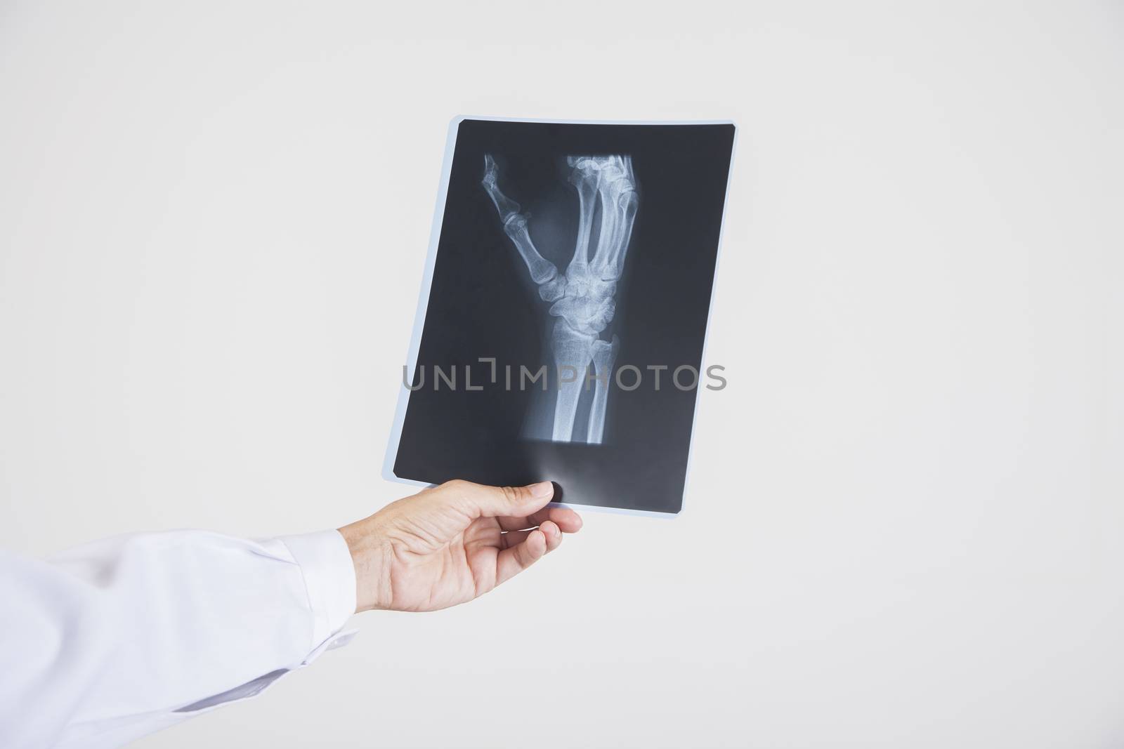 woman doctor hand with white gown and stethoscope with black radiography of hand skeleton isolated over white background