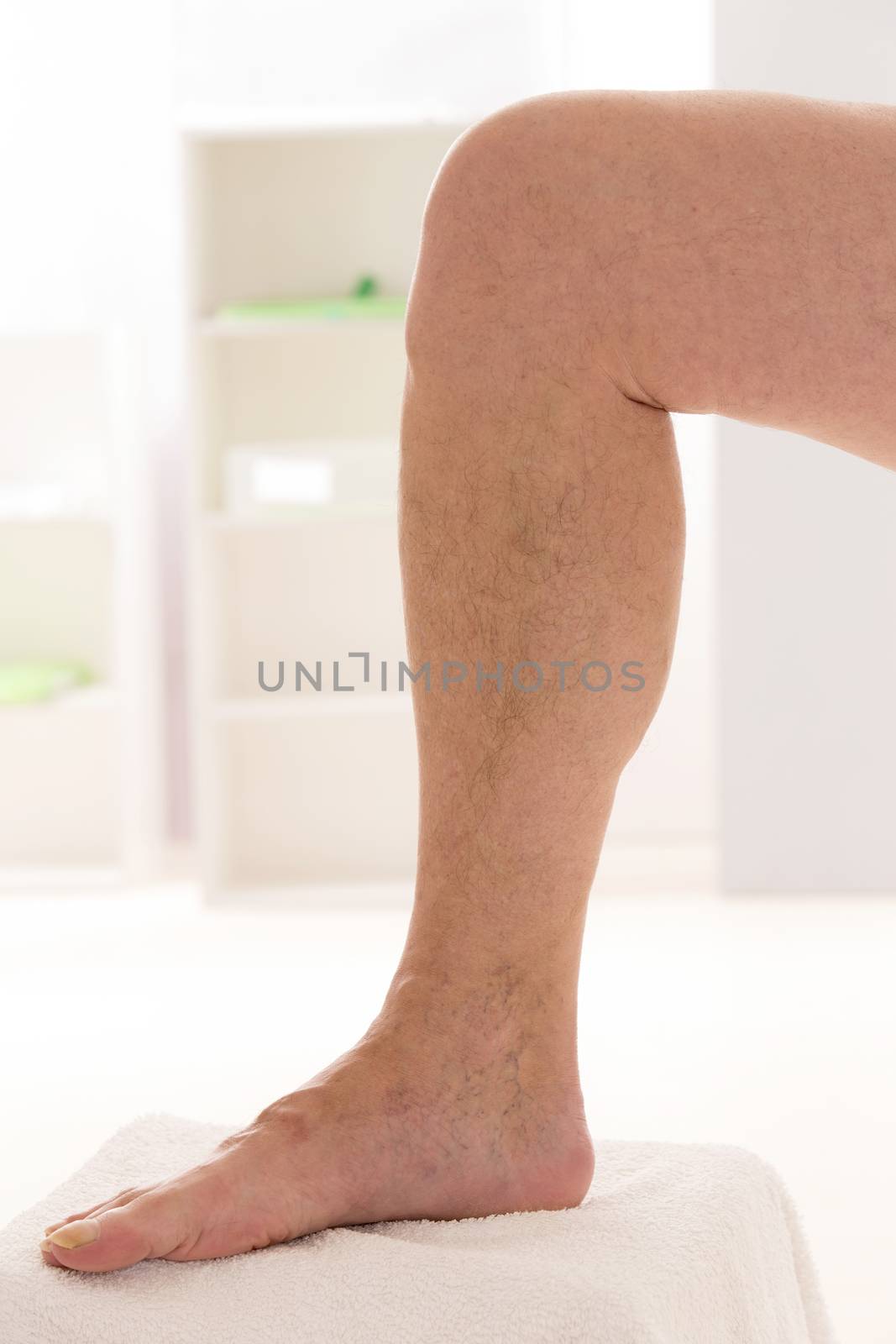 Varicose veins closeup, foot on modular bath step