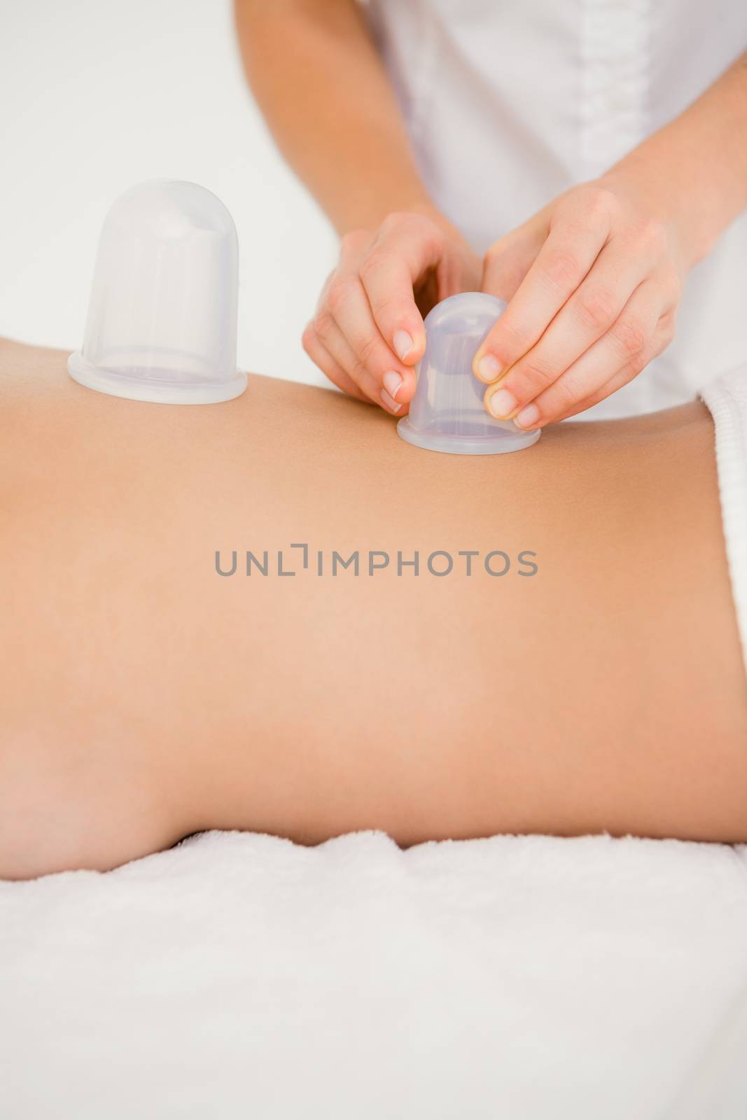 Woman with vacuum cups on her back at the health spa