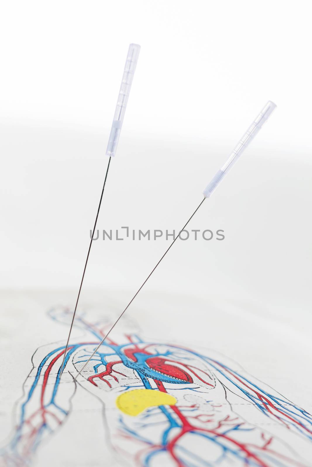 acupuncture needles on medicine book by JPC-PROD