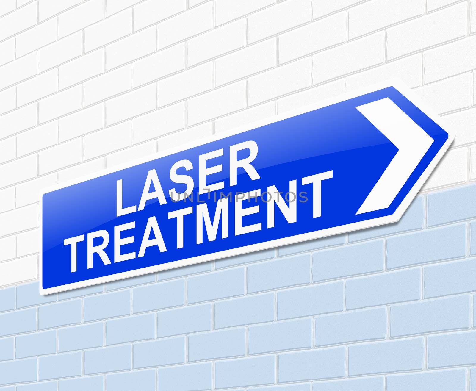 Illustration depicting a sign with a laser treatment concept.
