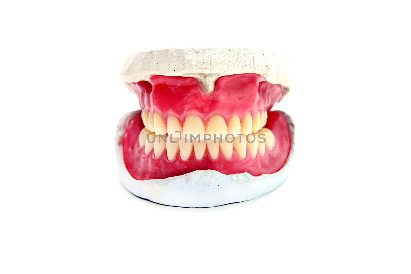human wax dental teeth mold isolated on white