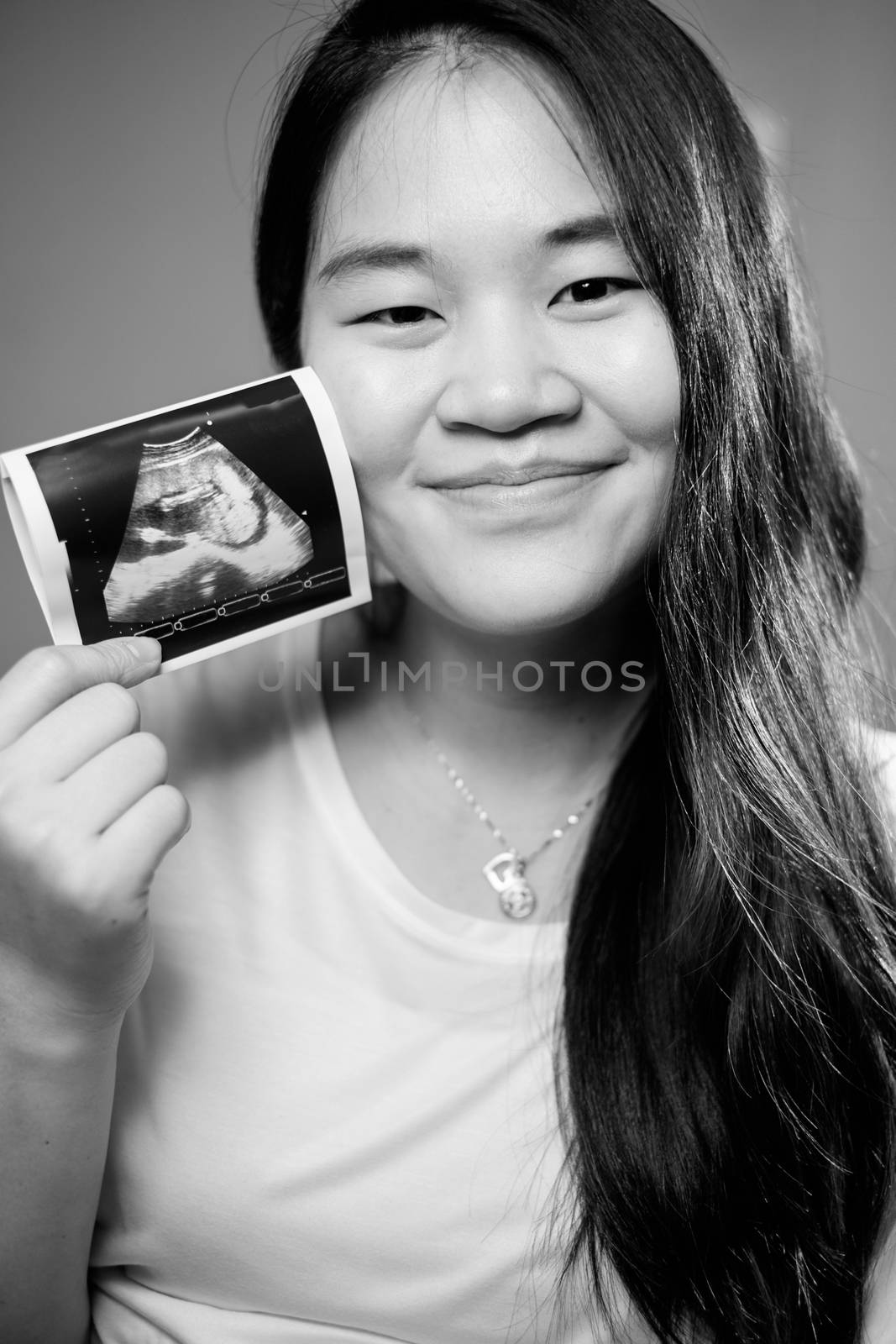 Asian pregnant women showing untrasond picture